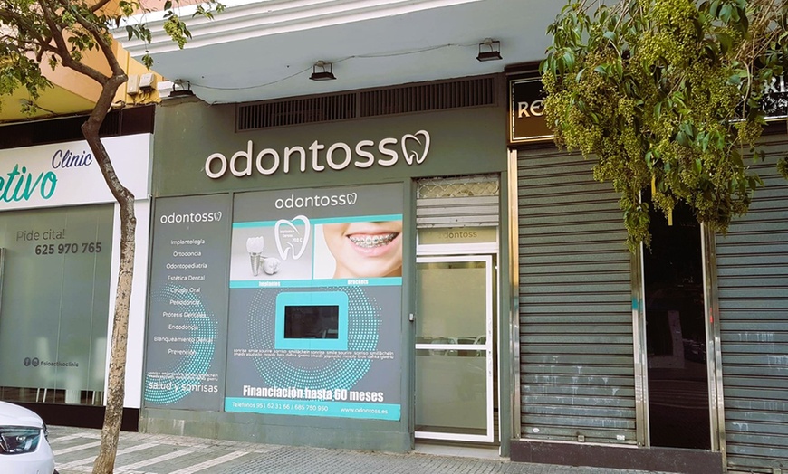 Image 7: Blanqueamiento dental con led en Clínica Dental Odontoss