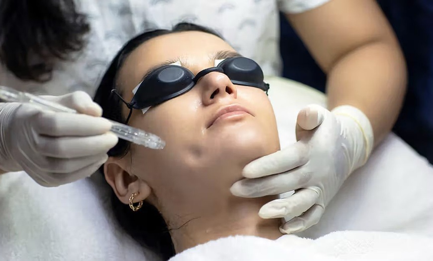 Image 2: Soin du visage Jet peel avec option LED à The French Riviera Studio