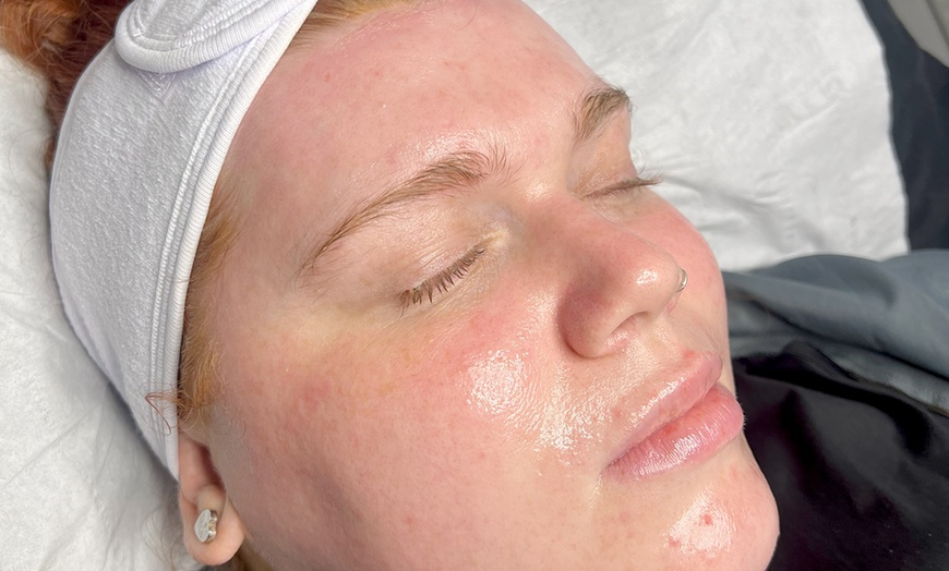 Image 3: Smooth Moves: Microdermabrasion/Classic Facial at The Skin Specialist