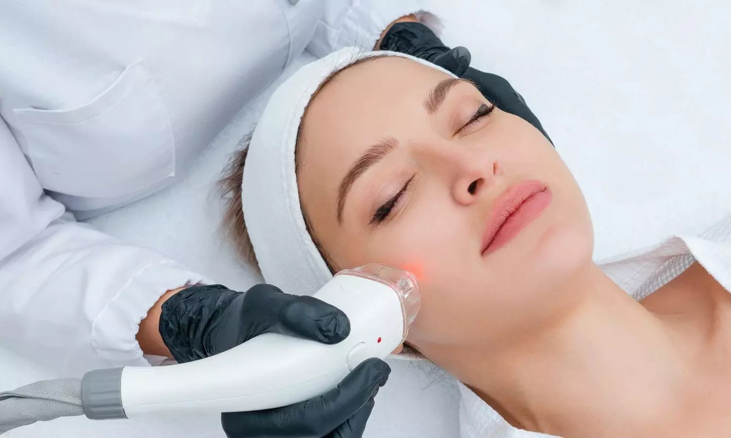 3 oder 5x Laser-Haarentfernung an einer kleinen oder mittleren Zone