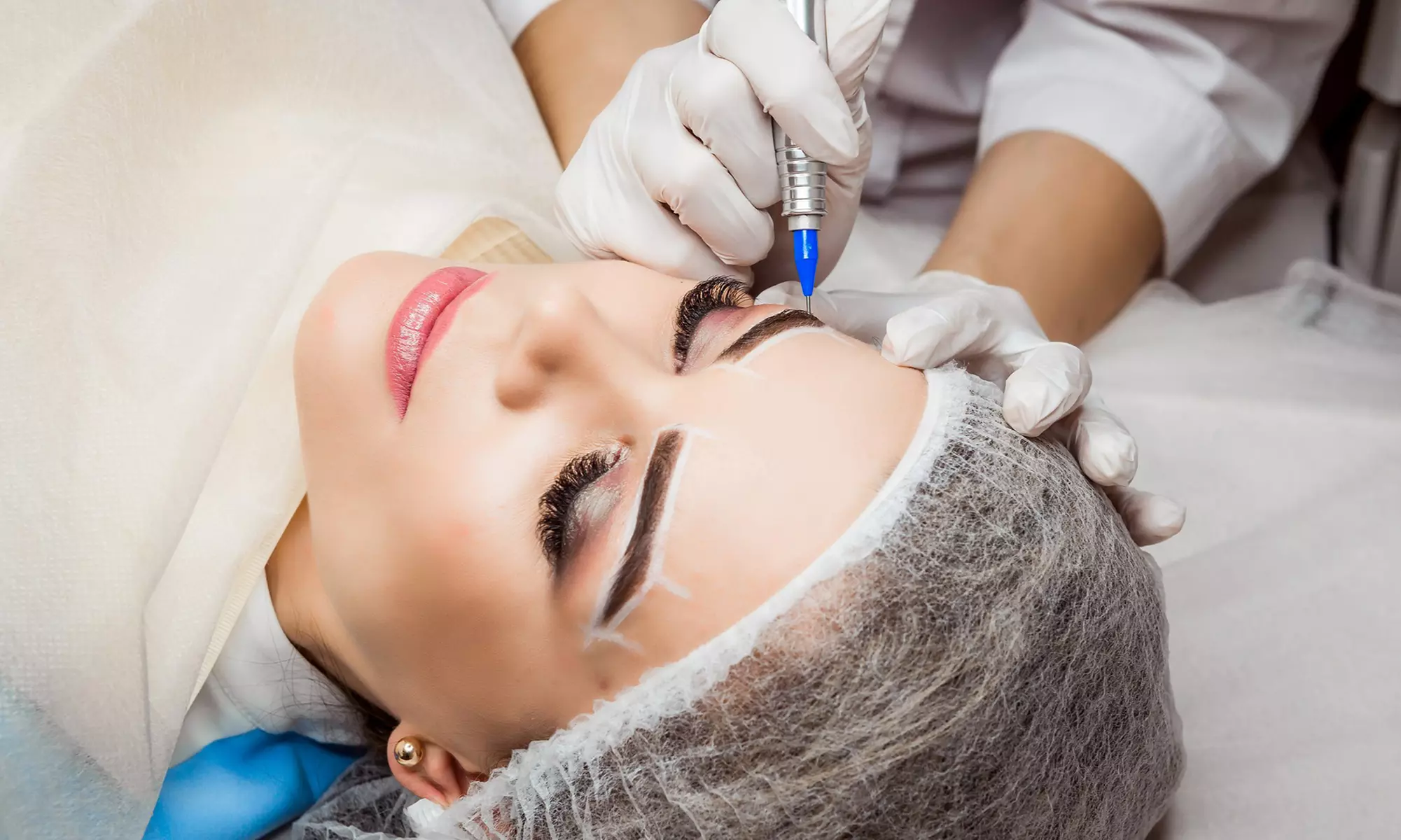 Eliminación de microblading en la cola de las cejas o cejas completas para 1 con hasta 50%  de descuento - Primary Image