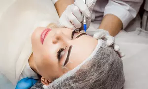 Eliminación de microblading en la cola de las cejas o cejas completas para 1 con hasta 50%  de descuento