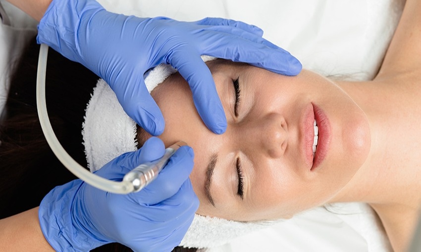 Up to 40% Off on Microdermabrasion at Vanity Hair And Body