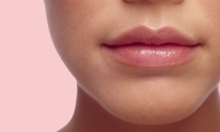 Non-Surgical Lip Augmentation Natural 1ml