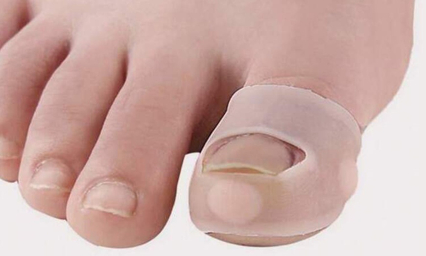 Image 5: One, Two or Five-Pack Of Silicone Ingrown Toenail Protector