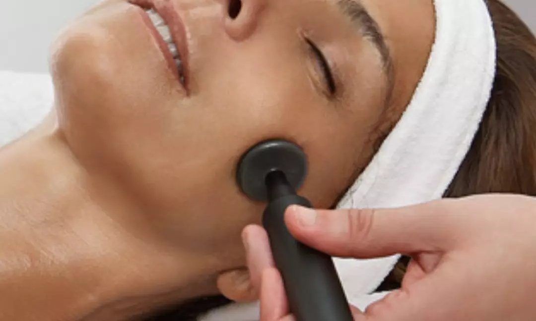 1, 2 o 3 sesiones de radiofrecuencia facial Indiba rostro completo