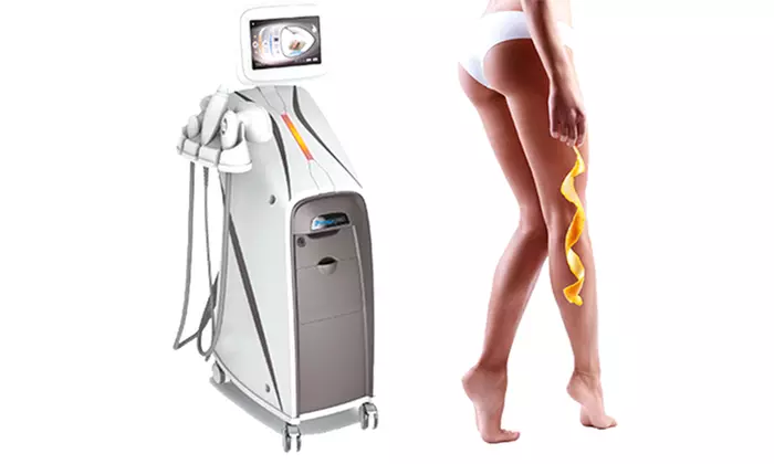 Cellulite-Behandlung mit T-Shape