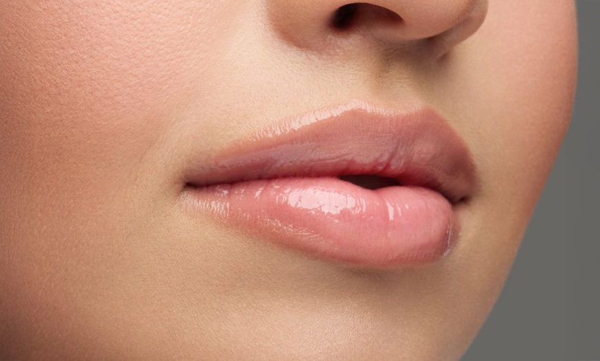 Image 1: Sesiones de rehidratación de labios o microlifting facial con Dermapen