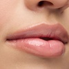 Image 1: Sesiones de rehidratación de labios o microlifting facial con Dermapen
