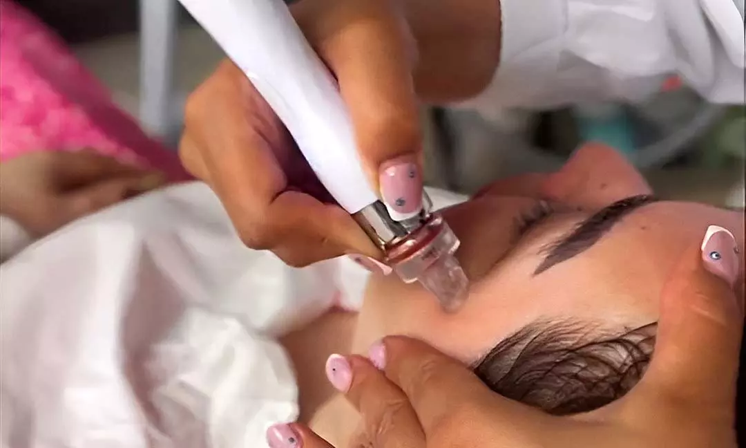 Up to 46% Off on HydraFacial at Golden Scissors Solihull - Primary Image