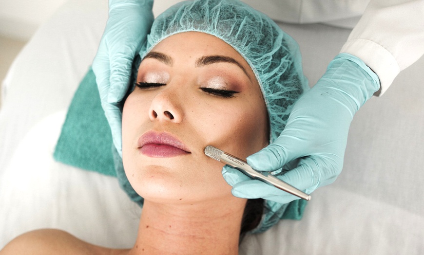 Image 1: One or Two Diamond Microdermabrasion Facials in Beverly Hills