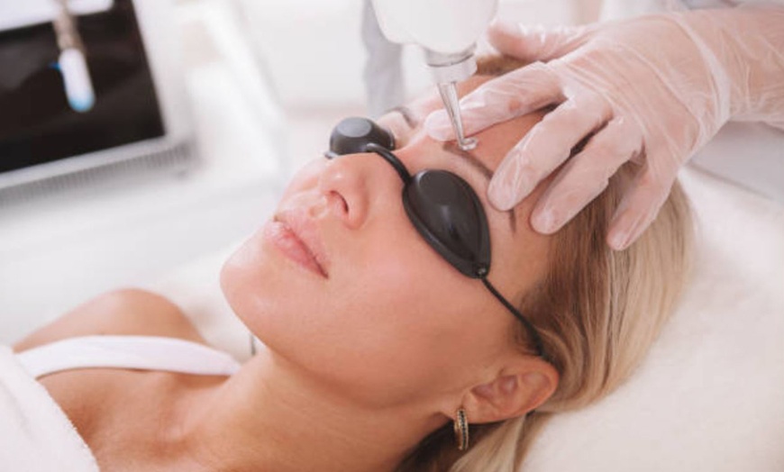 Image 12: Sesiones 3 o 6 para 5x5, 10x10 y 15x15 con láser q-switched Nd:YAG