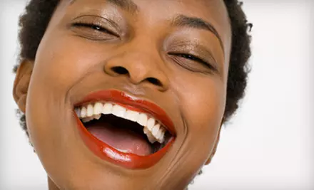 $150 for $300 Worth of In-Office Teeth Whitening at Balboa Smiles Dentistry - Primary Image