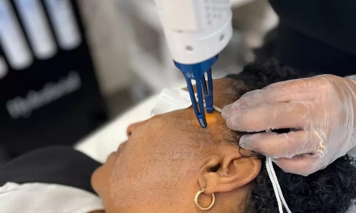 One, Three, or Five Laser Skin Resurfacing Treatments