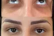 Up to 55% Off on Regain Confidence and Permanently conceal scars, stretchmarks, and dark under-eye circles - Second Medium