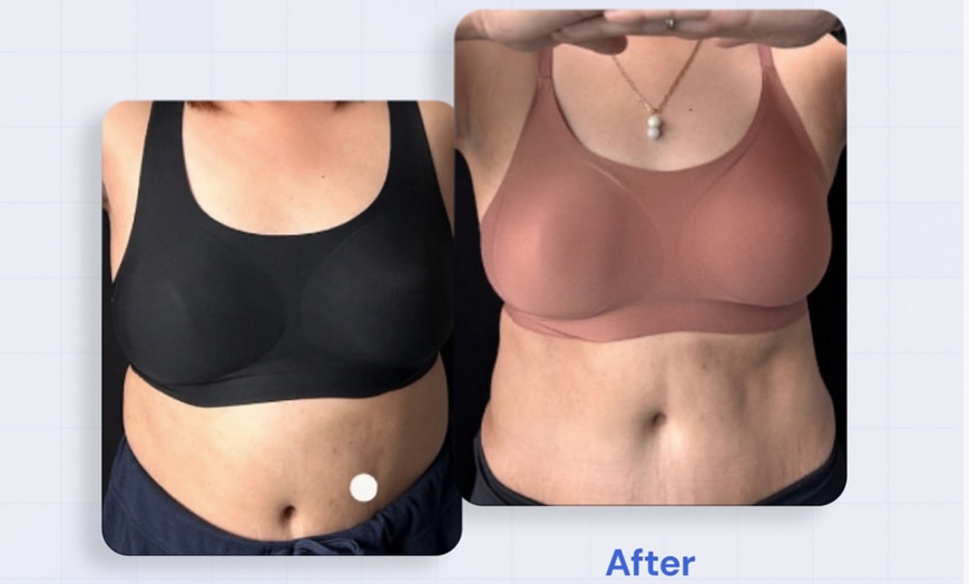 Image 6: Intro Cryo Slimming or 4 or 6 Cryo Contour Sessions