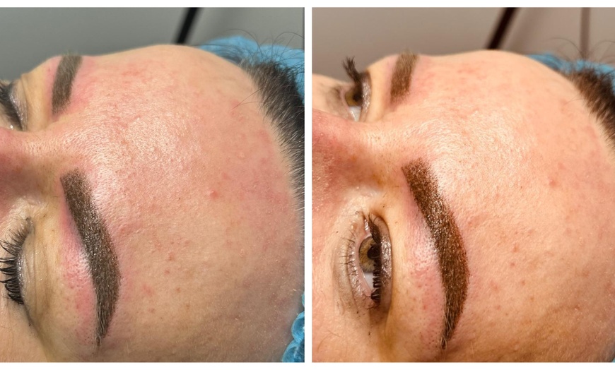 Image 1: Microblading or Ombre Microshading at Fami Beauty 