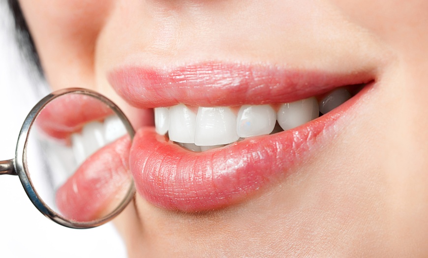 Image 1: One In-Office Teeth Whitening Treatment with(out) Checkup and Clean