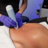 Image 1: Radio Frequency Skin Tightening Session w/ Ultrasound / Microneedling
