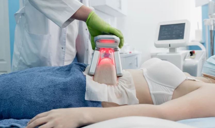 2, 4 o 6 sesiones dobles de criolipólisis