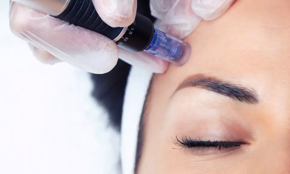 1 o 2 sesiones de limpieza facial con tratamiento a elegir para 1