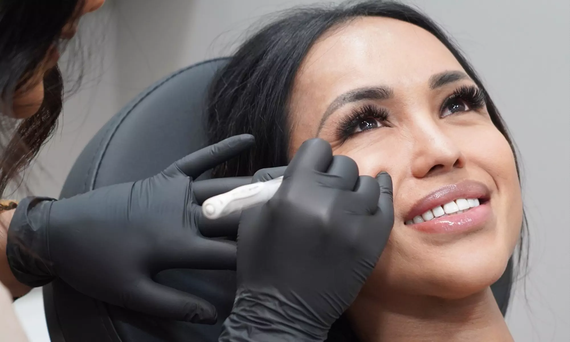 Enjoy Skin Needling With LED Therapy, Face Mask, And Consultation