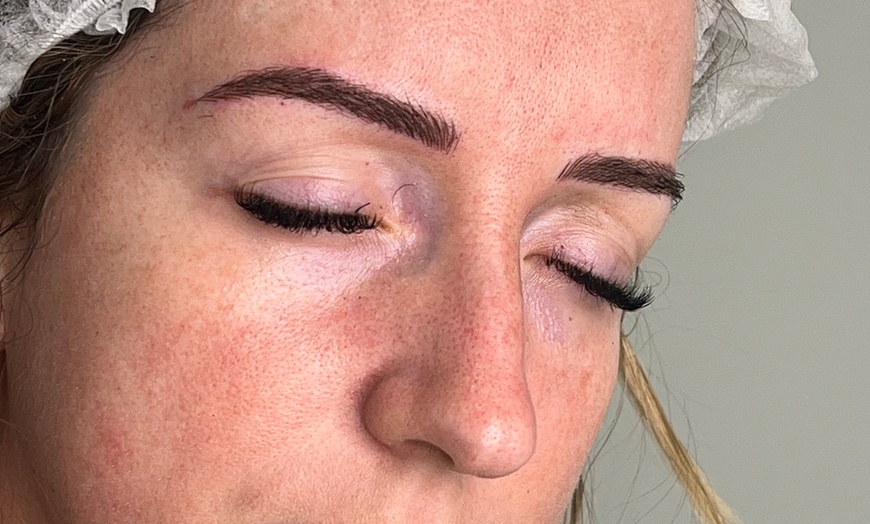 Image 15: Microblading Session with Touch Up at Elizabeth Beauty and Laser