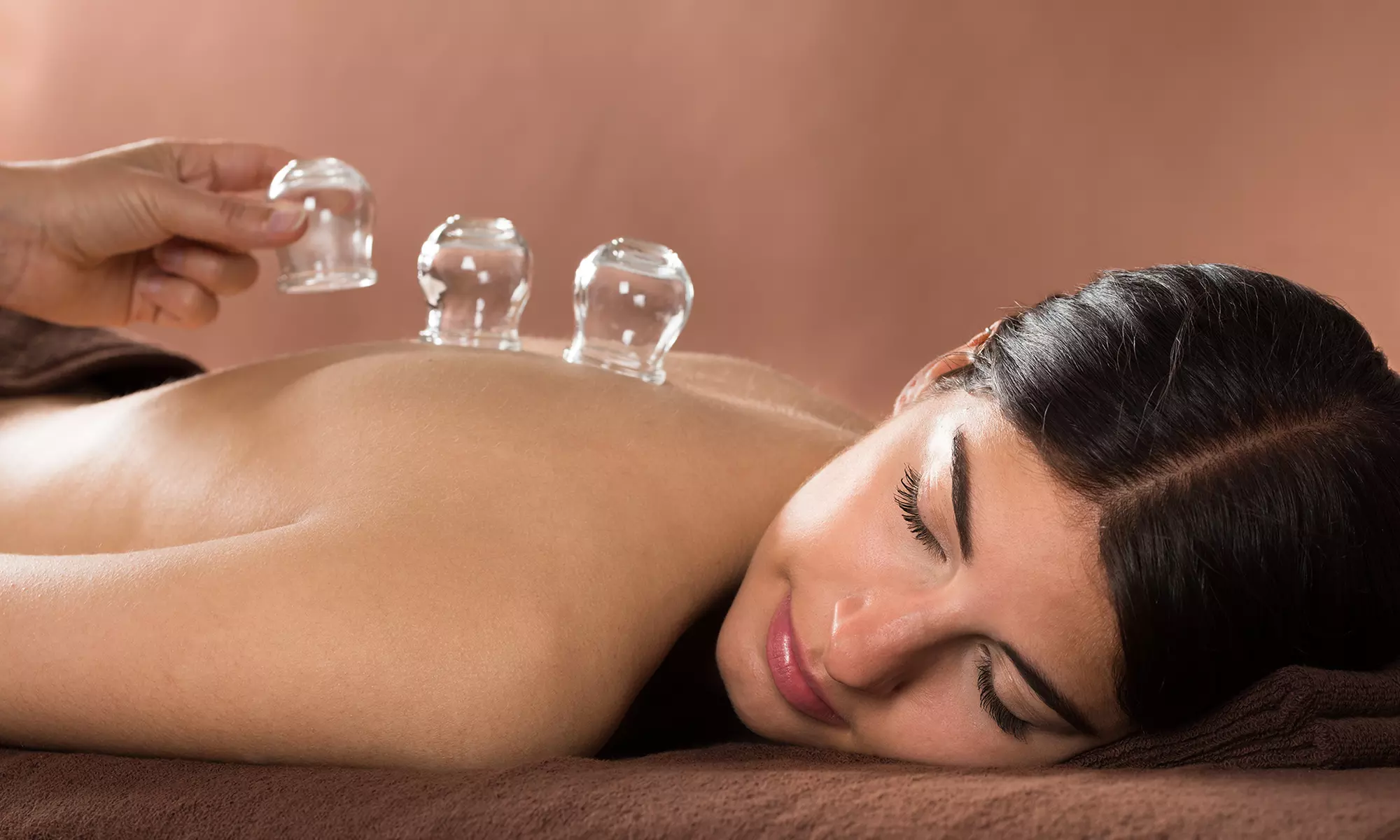 One or Three Cupping Sessions at Stirling Spinal Health (Up to 54% Off) - Primary Image