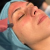 Image 3: Enhance Skin Texture with Micro-Needling Options