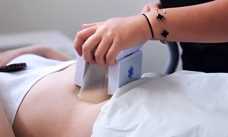 Image 1: Transform Your Body: Radio Frequency, Cavitation and Lipo Freeze