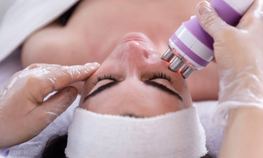 Image 12: Revitaliza tu piel con una limpieza facial con tratamientos a elegir