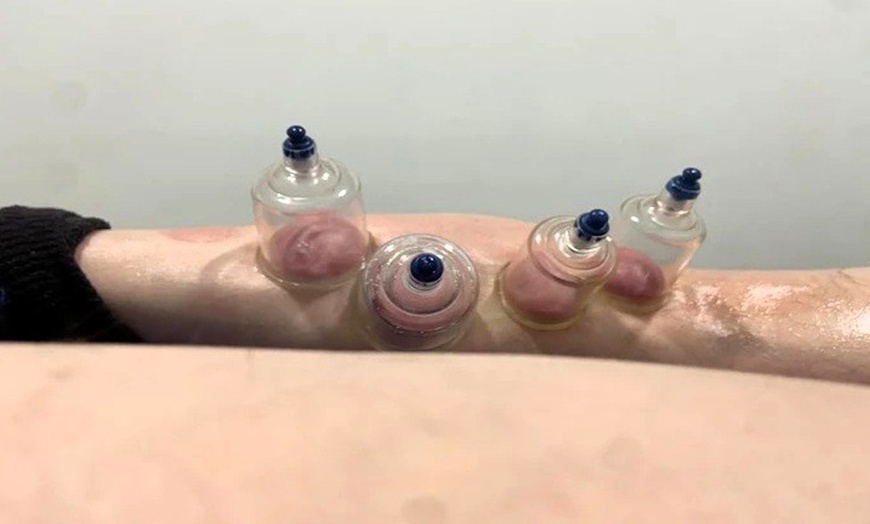 Image 2: Fisioterapia avanzada con diagnóstico previo en 1, 2 o 4 sesiones 