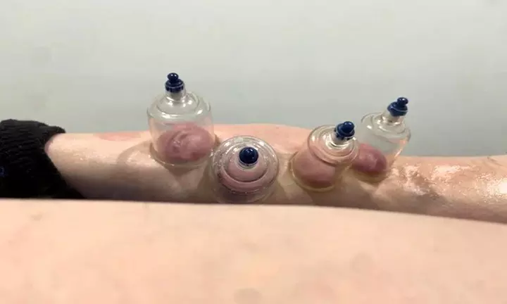 Fisioterapia avanzada con diagnóstico previo en 1, 2 o 4 sesiones