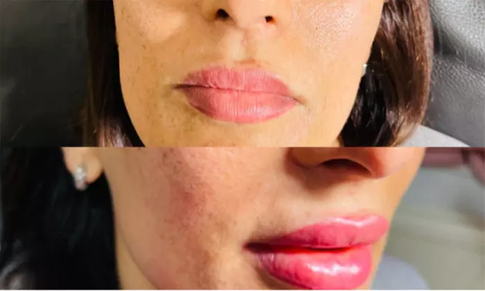 Up to 67% Off on Microblading at Maria cosmetic clinic