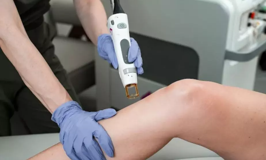 6 Candela Laser Sessions for Smooth, Hair-Free Skin