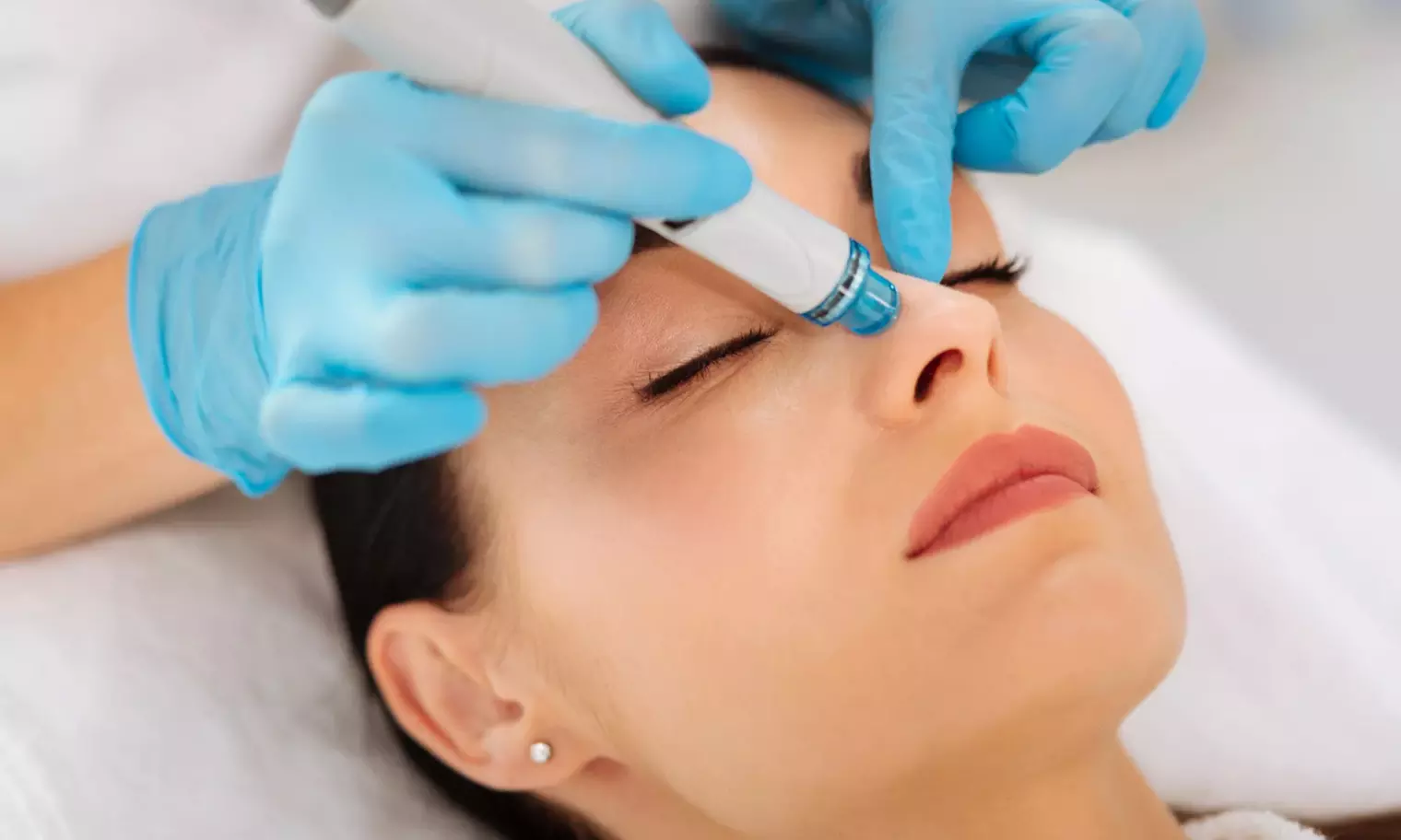 Soin visage Microneedling ou Hydra Soin Visage d'1h chez Les Secrets D'Ève (jusqu'à 47% de remise) - Primary Image