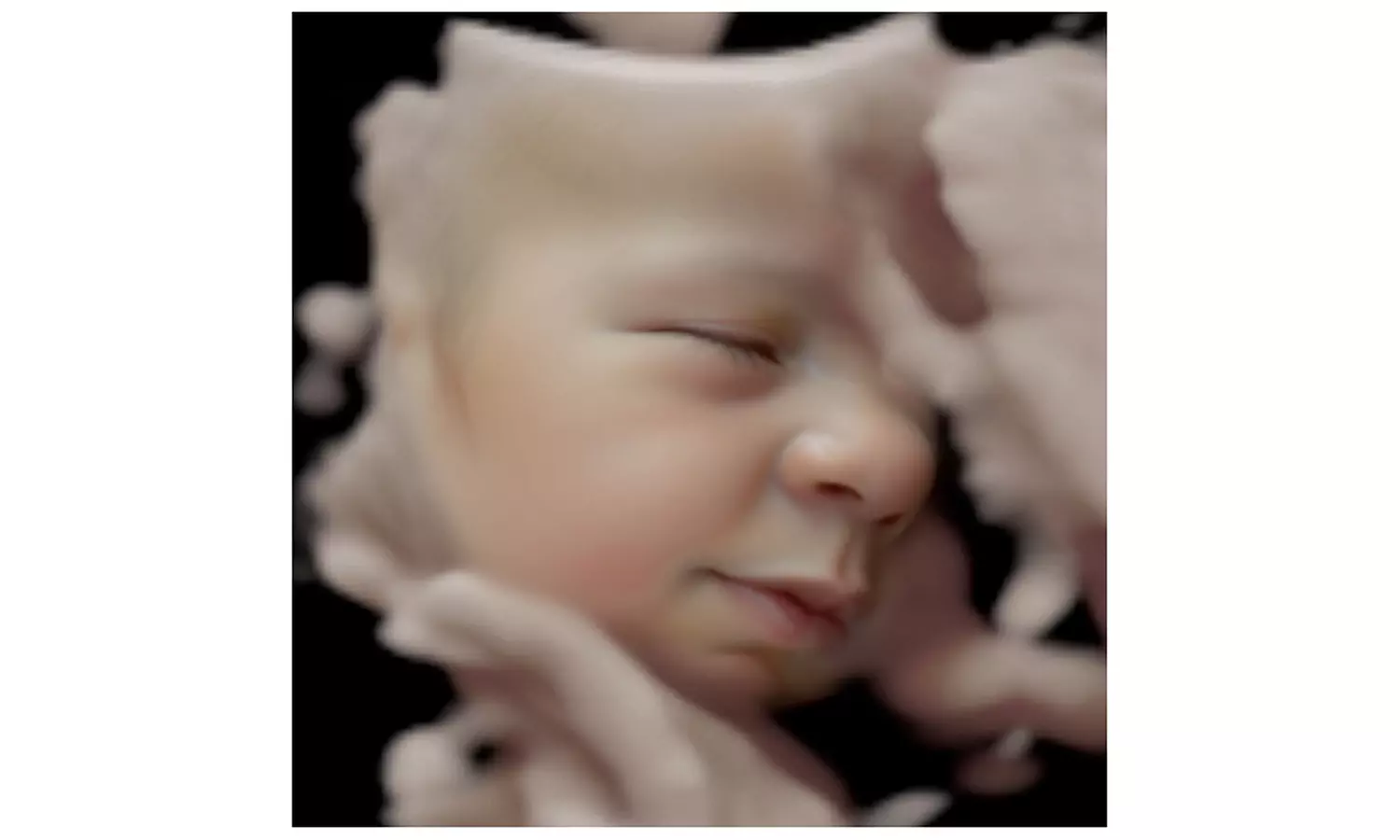 Visualiza a tu bebé: ecografía 8K o para descubrir el sexo del bebé