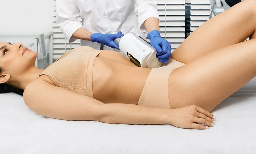 Image 2: Smooth & Sculpt: 1 or 3 Anti-Cellulite Body Treatment Endosphere 