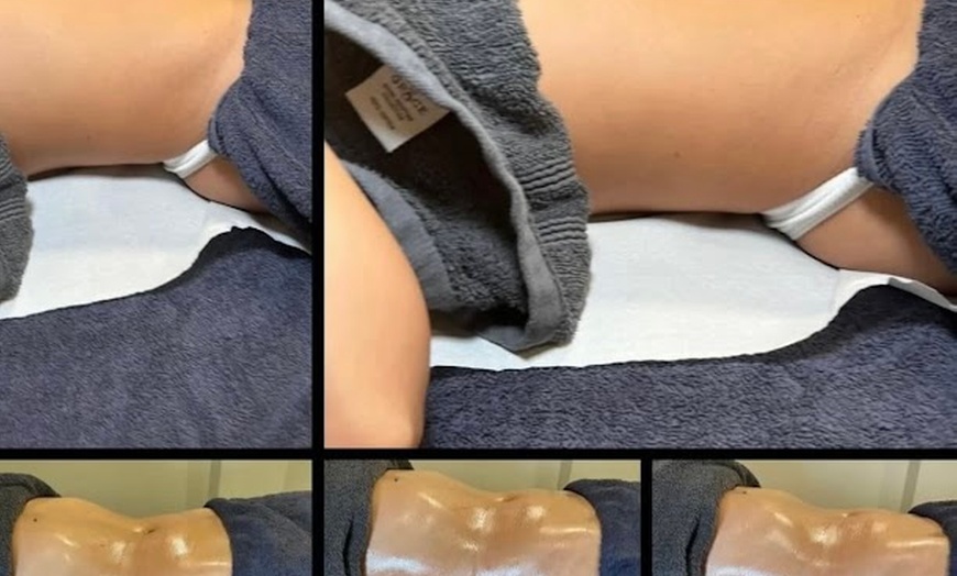 Image 2: Relax w/ One, Three or Five Sessions: Lymphatic Massage 1 or 2 Areas 