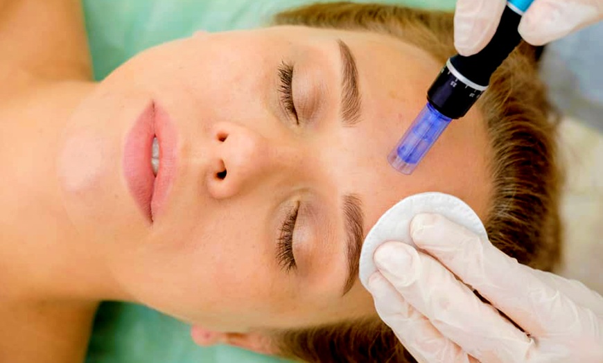 Image 9: 1 o 3 sesiones de dermapen facial con vitaminas o exosomas