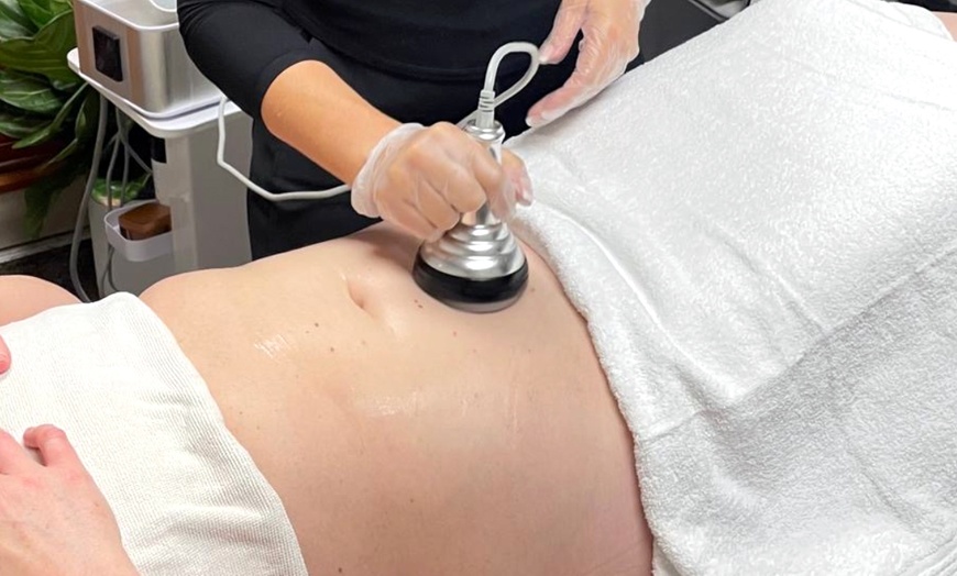 Image 2: Firmer, Youthful Skin with Radio Frequency Tightening for Face or Neck