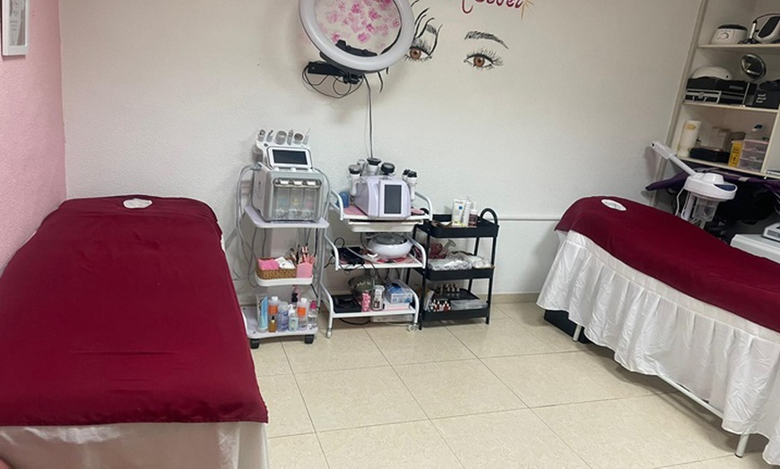 Image 2: Disfruta de 1 o 2 sesiones de radiofrecuencia facial en Alicante