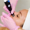 Image 10: Up To 20, 40, or 60 Units of Botox at LightRx 