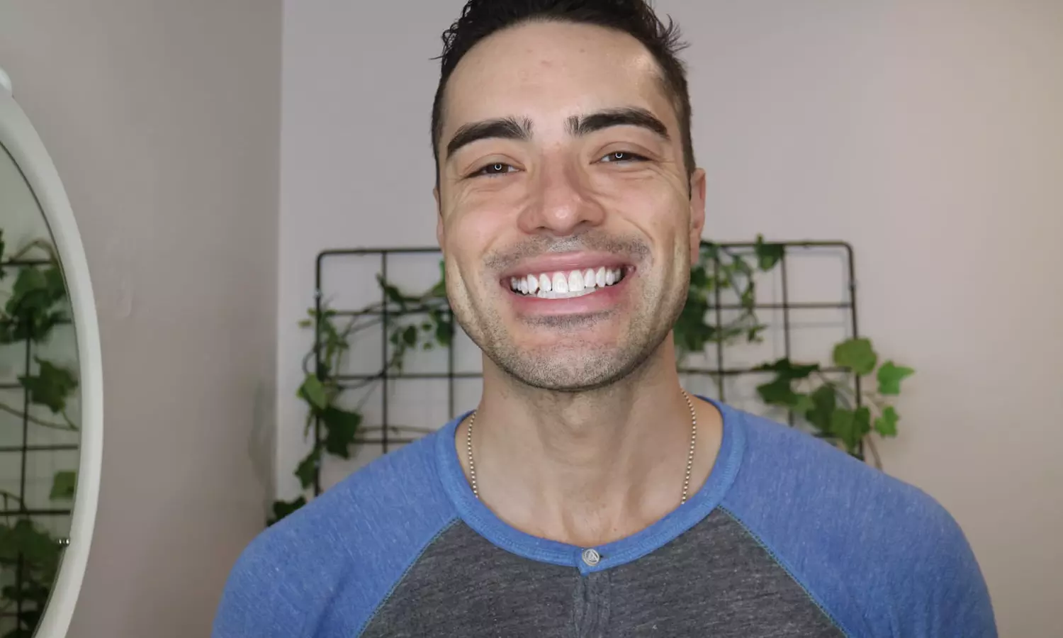 Premium 60-Minute Teeth Whitening at Smile Labs Penrith