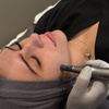 Image 2: Enhance Skin Texture with Micro-Needling Options