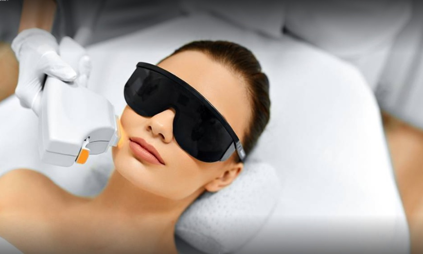 Image 1: Laser Hair Removal at Venus Beauty