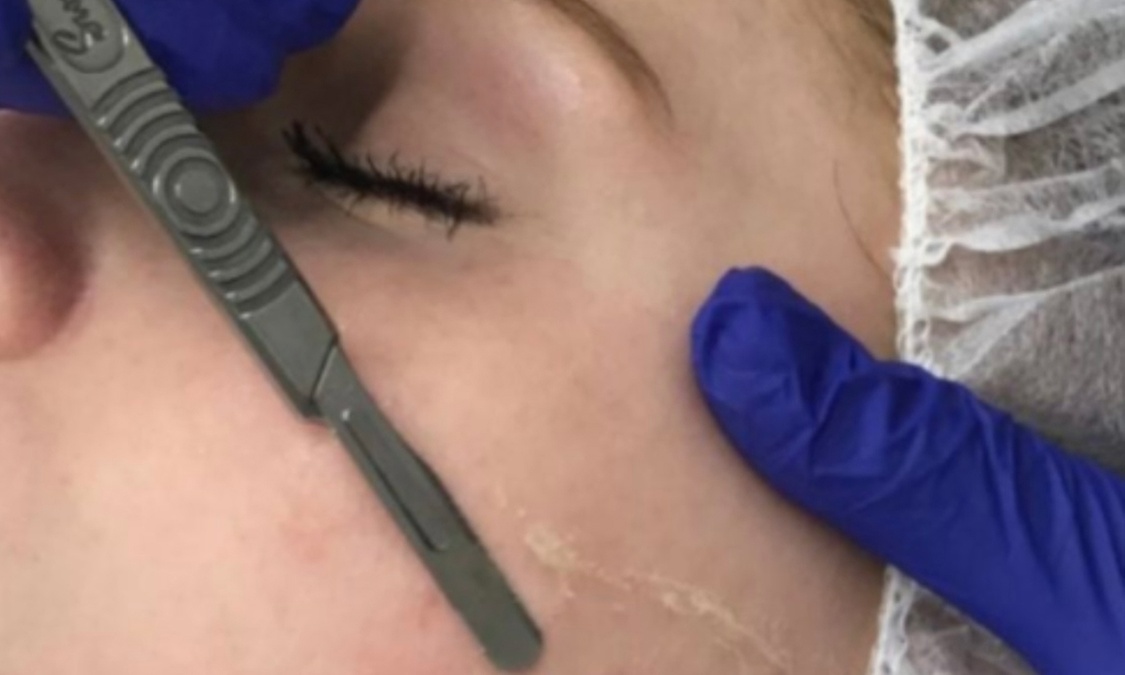 Experience Skin Care by Tatyana's exfoliating and rejuvenating treatments with options for dermaplaning and more, up to 46% off