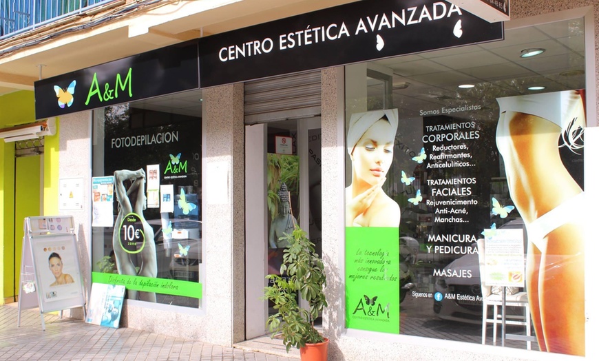 Image 6: Tratamiento remodelador en A&M Estética Avanzada