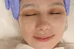 Revitalize Your Skin: One or Three Light or Deep Chemical Peels at Health Link Medical Group ( Up to 65% Off ) - Second Medium