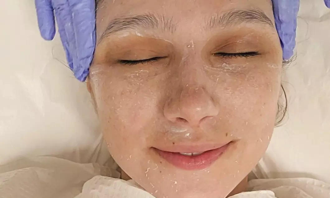 Experience Radiance: One or Three Light or Deep Chemical Peels